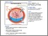 [thumbnail of Beggs_Potentiation of Synaptic GluN2B NMDAR Currents by Fyn Kinase Is Gated through BDNF-Mediated Disinhibition in Spinal Pain Processing_VoR.pdf]