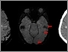 [thumbnail of Figure 4_new.jpg]
