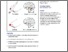 [thumbnail of Wesselink_Organised toe maps in extreme foot users_VoR.pdf]