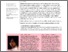 [thumbnail of 23311908.2017.1304018.pdf]
