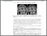 [thumbnail of Reversible frontotemporal brain sagging syndrome..pdf]