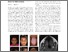 [thumbnail of Extending the spectrum of AKT1 mosaicism: not just the Proteus syndrome.pdf]