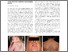 [thumbnail of Kinsler_et_al-2017-British_Journal_of_Dermatology.pdf]