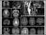 [thumbnail of Figure 2 revised.tiff]
